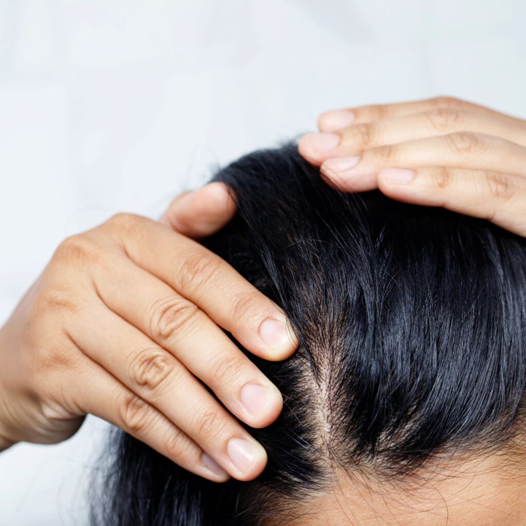 Alergia a los tintes de pelo