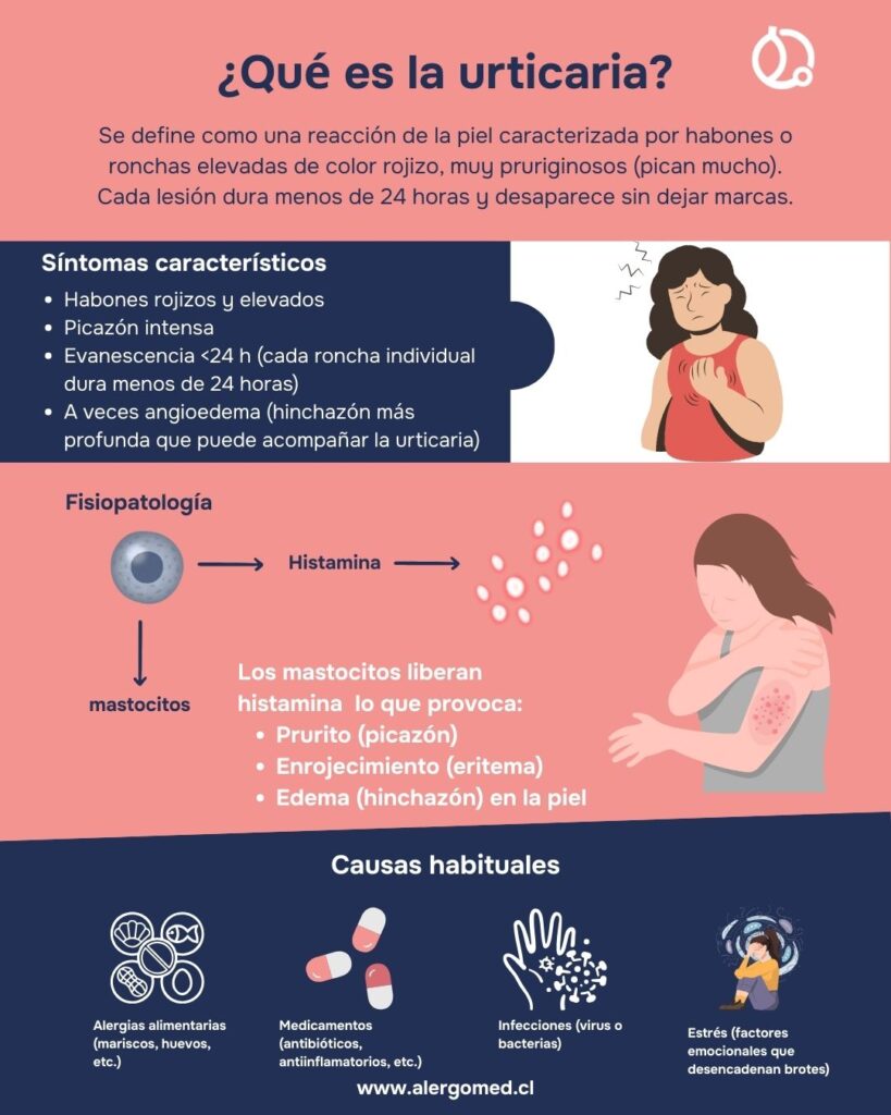 ¿Qué es la urticaria? Entendiendo sus síntomas y causas
