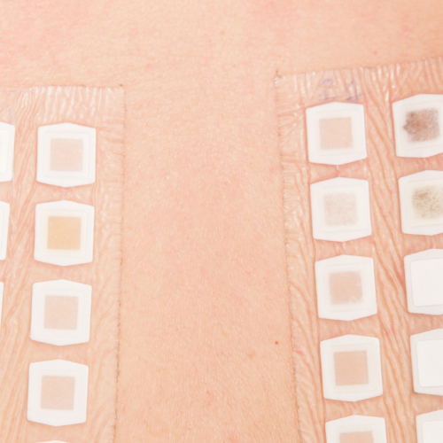 Test de parche para alimentos