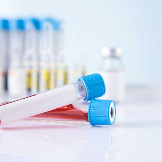 Exámenes de Sangre para Alergias